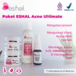 thumb 5 -- Paket ESHAL Acne Ultimate