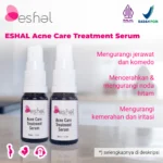 thumb 5 -- ESHAL Acne Care Treatment